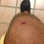I got a pretty good gash on my knee courtesy of the waves at the Islas Marietas.
